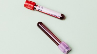 Photo of KRENULO VELIKO TESTIRANJE Otkrit će se tko je imao virus, a da nije znao