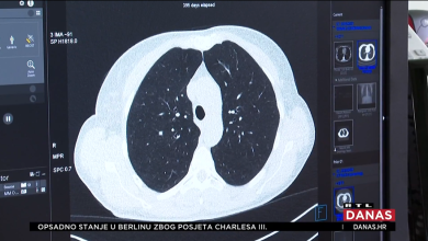Photo of VIDEO Hrvatska ima prvi program u Europi koji dijagnosticira rak, a sada ga svi žele